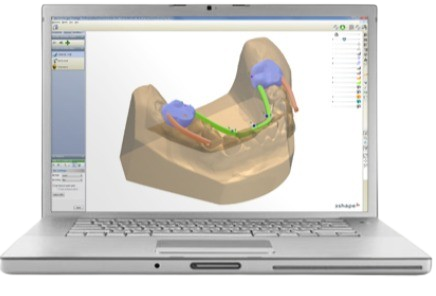 analyzing 3D models of a patient